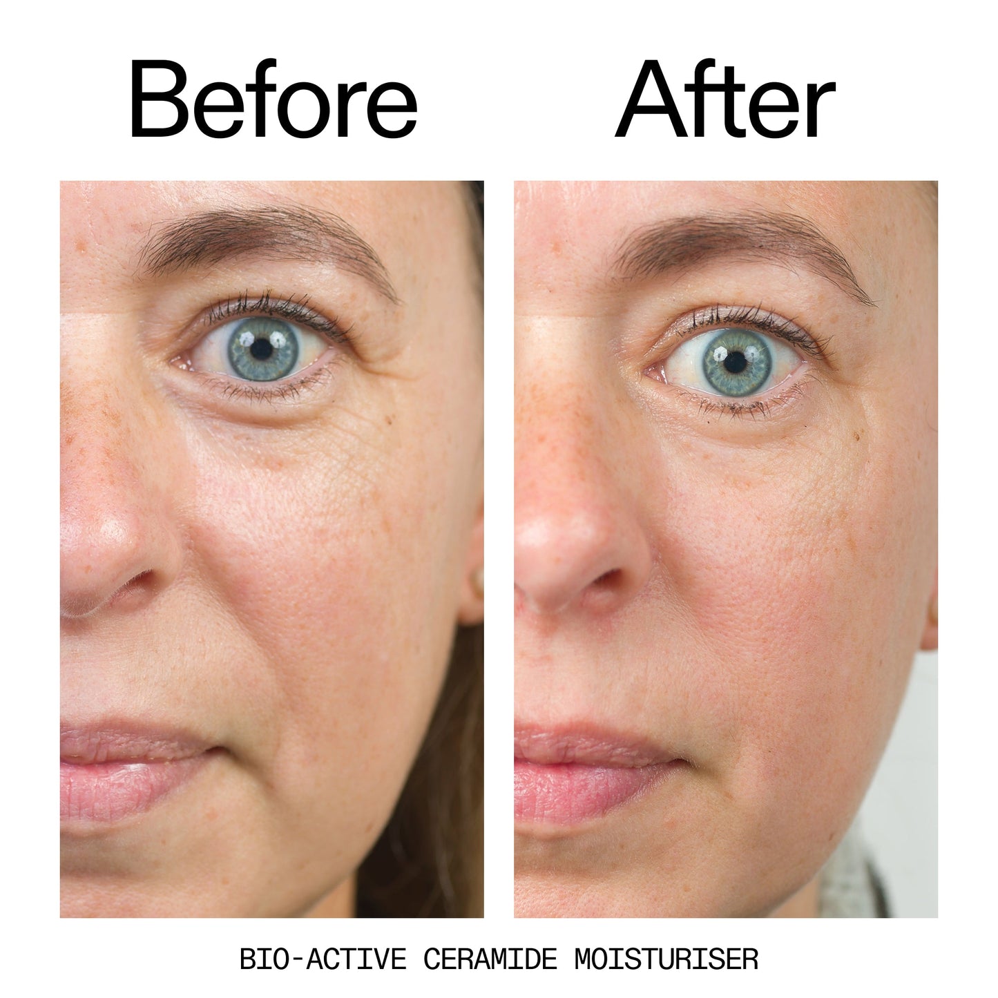 barrier-boosting-trio-q5 Bio-Active_Before_After_2000x2000_600947b4-e8c5-425a-9155-fc15bc83aa12.jpg