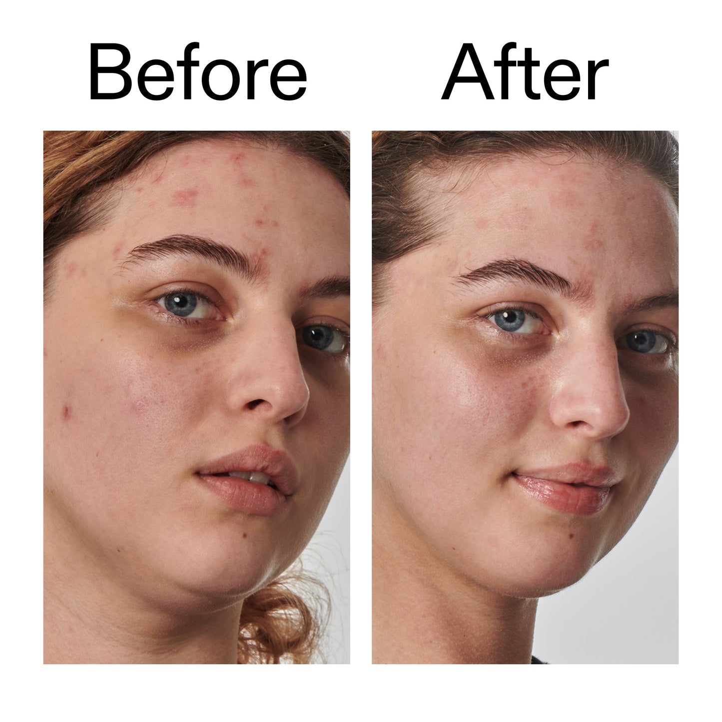 10-urea-moisturizer-g1 Dry_and_Rough_Skin_Solution_Before_After_2000x2000_efa6e639-5c39-49bd-a5dd-f0220293120a.jpg
