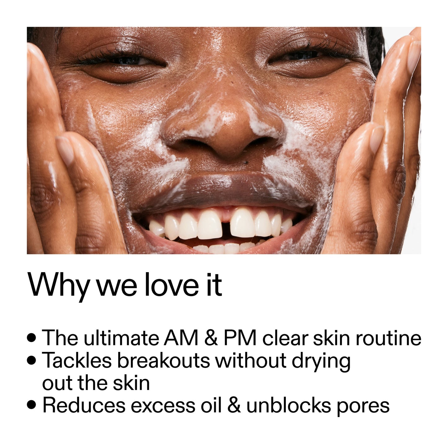 intro-routine-for-acne-z9 Intro_Routine_for_Acne_Why_we_love_it_2000x2000_42499e10-4629-4a0e-a627-7e215f4da6bc.jpg