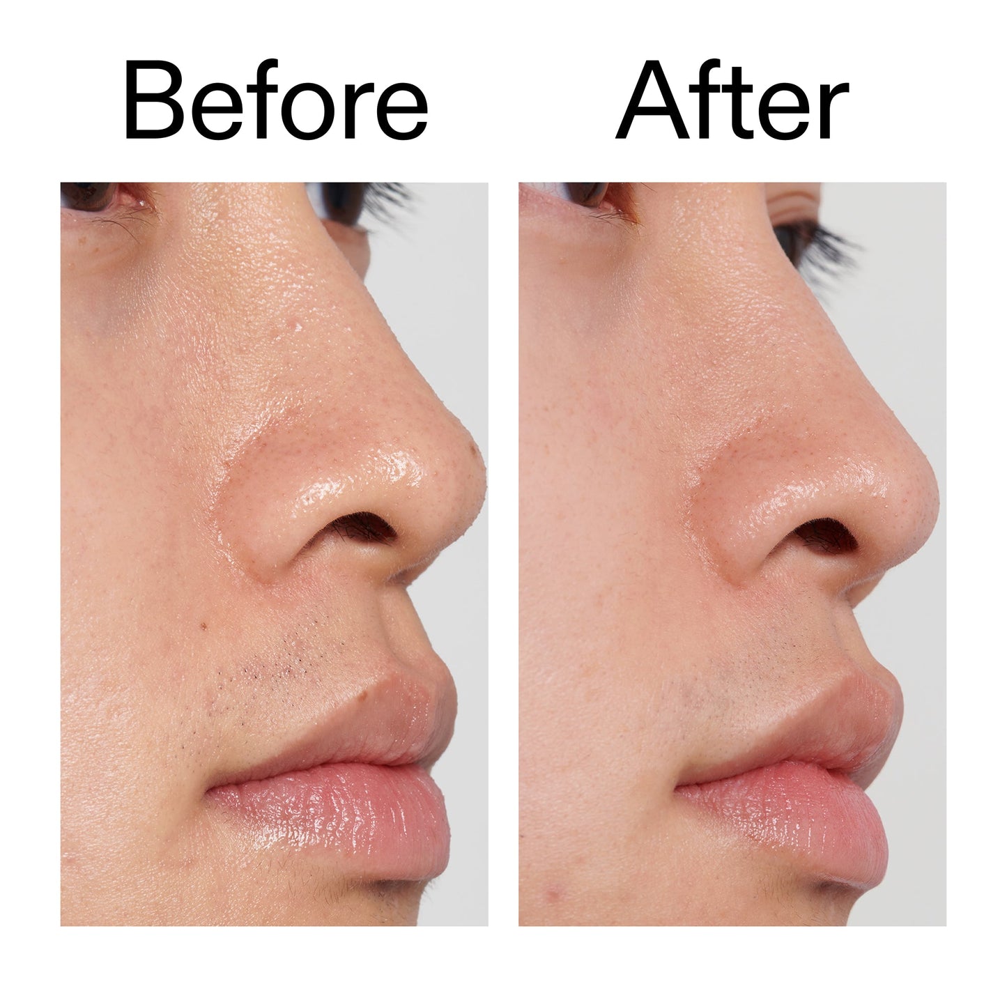 pha-toner-j0 PHA_Toner_Before_After_2000x2000_e3c10172-0150-4342-8b95-57417eaff50d.jpg