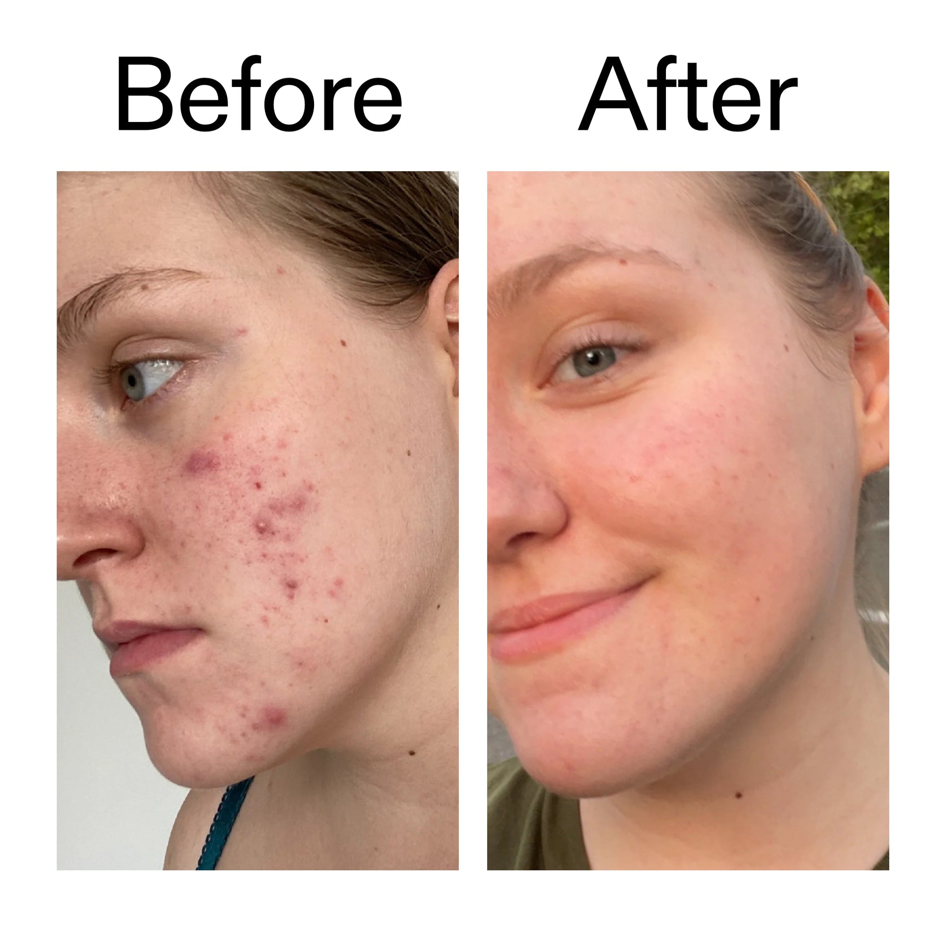 15-vitamin-c-egf-serum-g9 15_Vitamin_C_EGF_Serum_Before_After_2000x2000_fb9f598a-3386-40c8-8143-36f9d7a17ec8.jpg