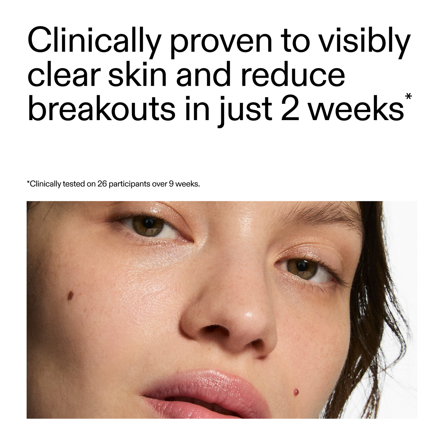 360-acne-clearing-duo-l1 360_Serum_Key_Claim.png