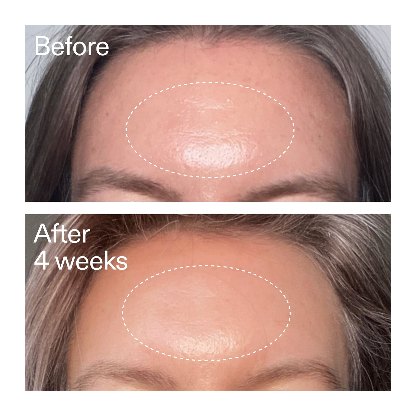 advanced-0-2-retinal-serum-j0 AdvancedRetinal_BeforeAfter1_2000x2000_1da6bb0a-29dd-41d1-95b7-8679696bbf0f.jpg