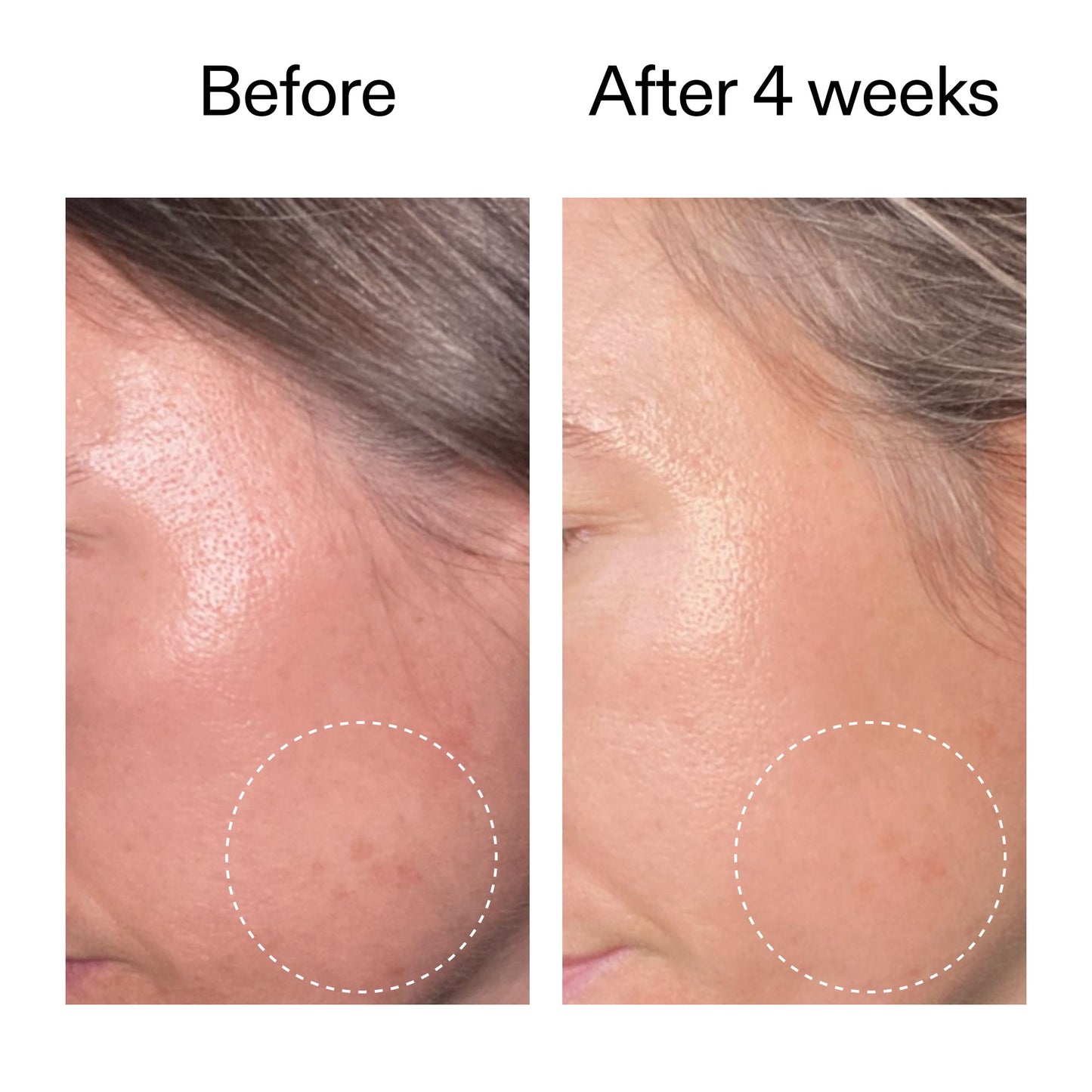 advanced-0-2-retinal-serum-duo-o5 AdvancedRetinal_BeforeAfter2__2000x2000_8ef75542-2316-4814-81ee-0f66a85912bc.jpg