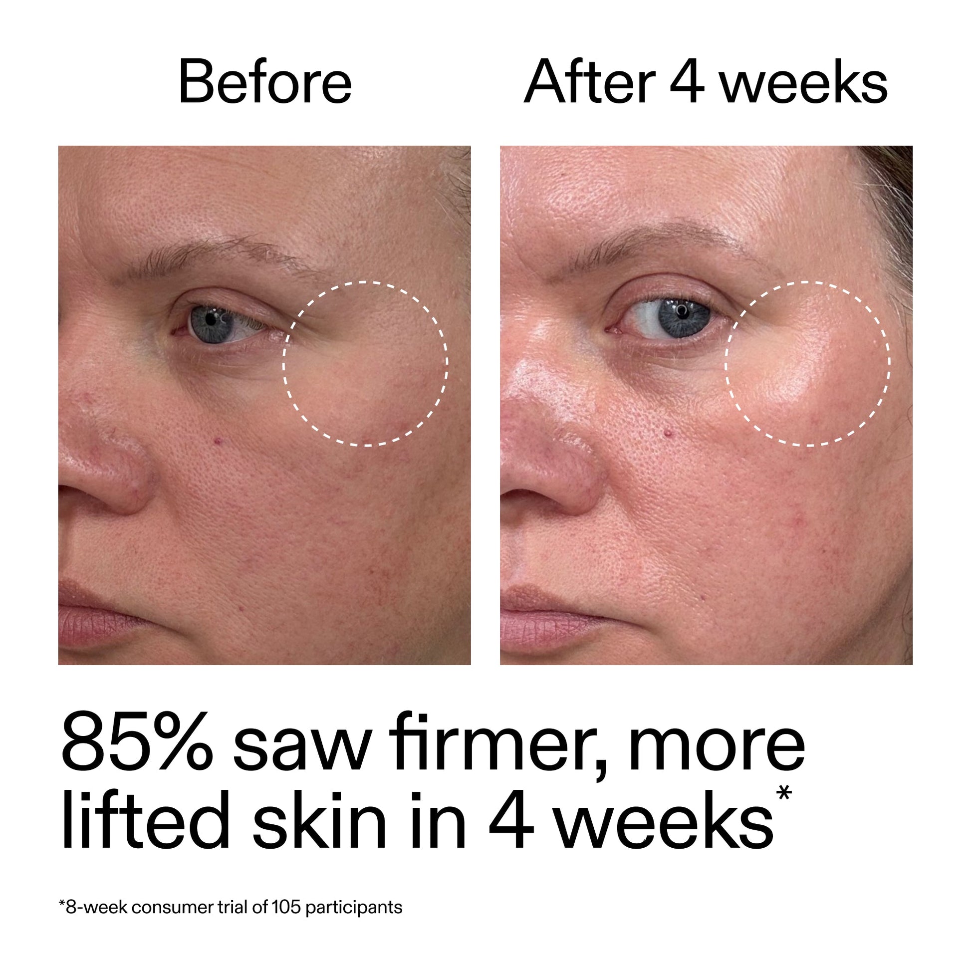 advanced-0-2-retinal-serum-j0 AdvancedRetinal_BeforeAfter_Claim1_2000x2000_bcc385c4-5e73-4f1e-aba8-64267937d0d3.jpg