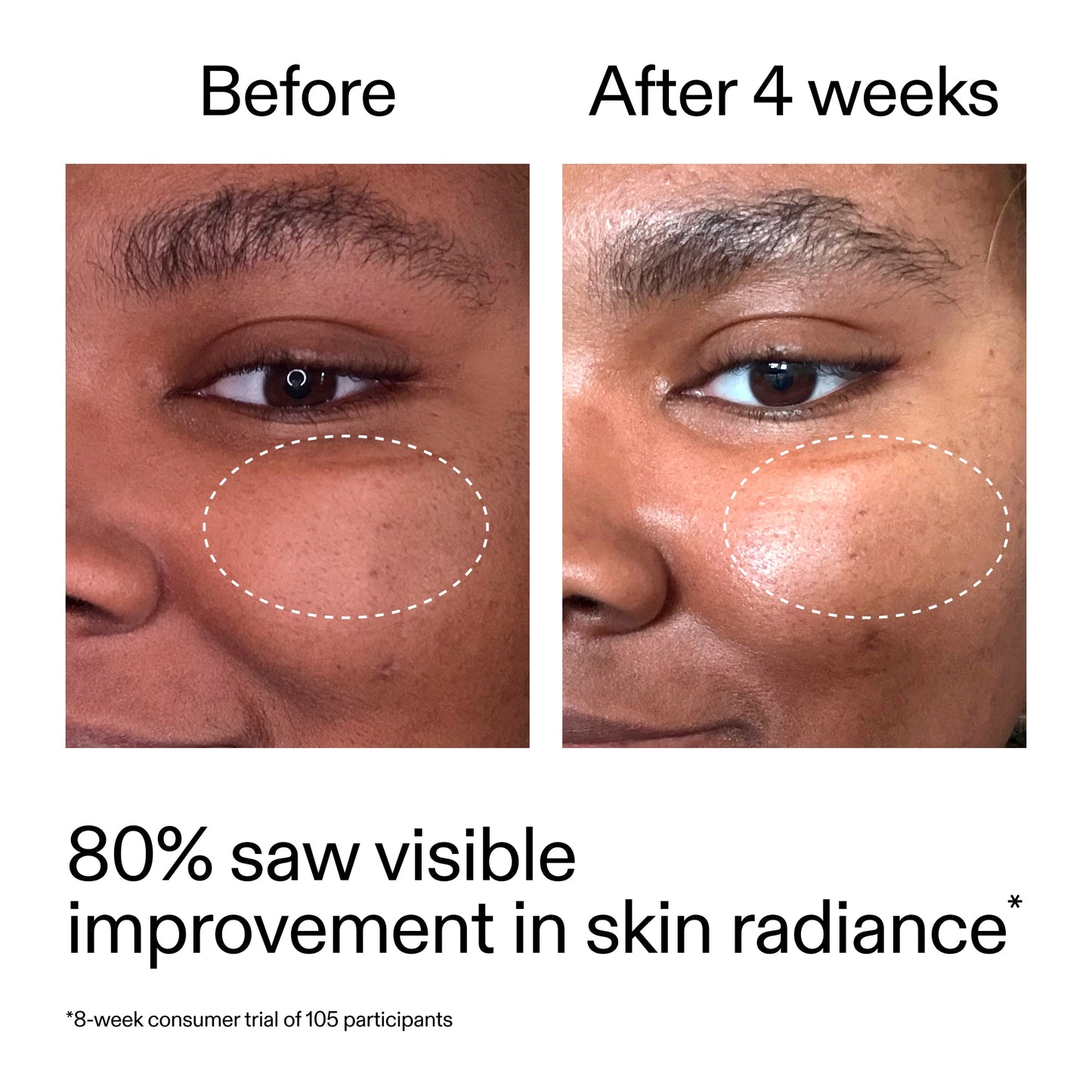advanced-0-2-retinal-serum-duo-o5 AdvancedRetinal_BeforeAfter_Claim2_2000x2000_681b621d-8d44-4d44-9a40-89244f9b2e53.jpg