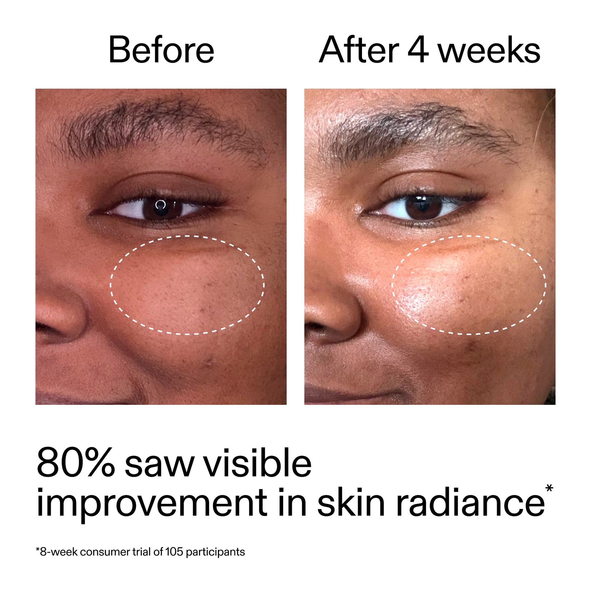 advanced-0-2-retinal-serum-duo-o5 AdvancedRetinal_BeforeAfter_Claim2_2000x2000_681b621d-8d44-4d44-9a40-89244f9b2e53.jpg