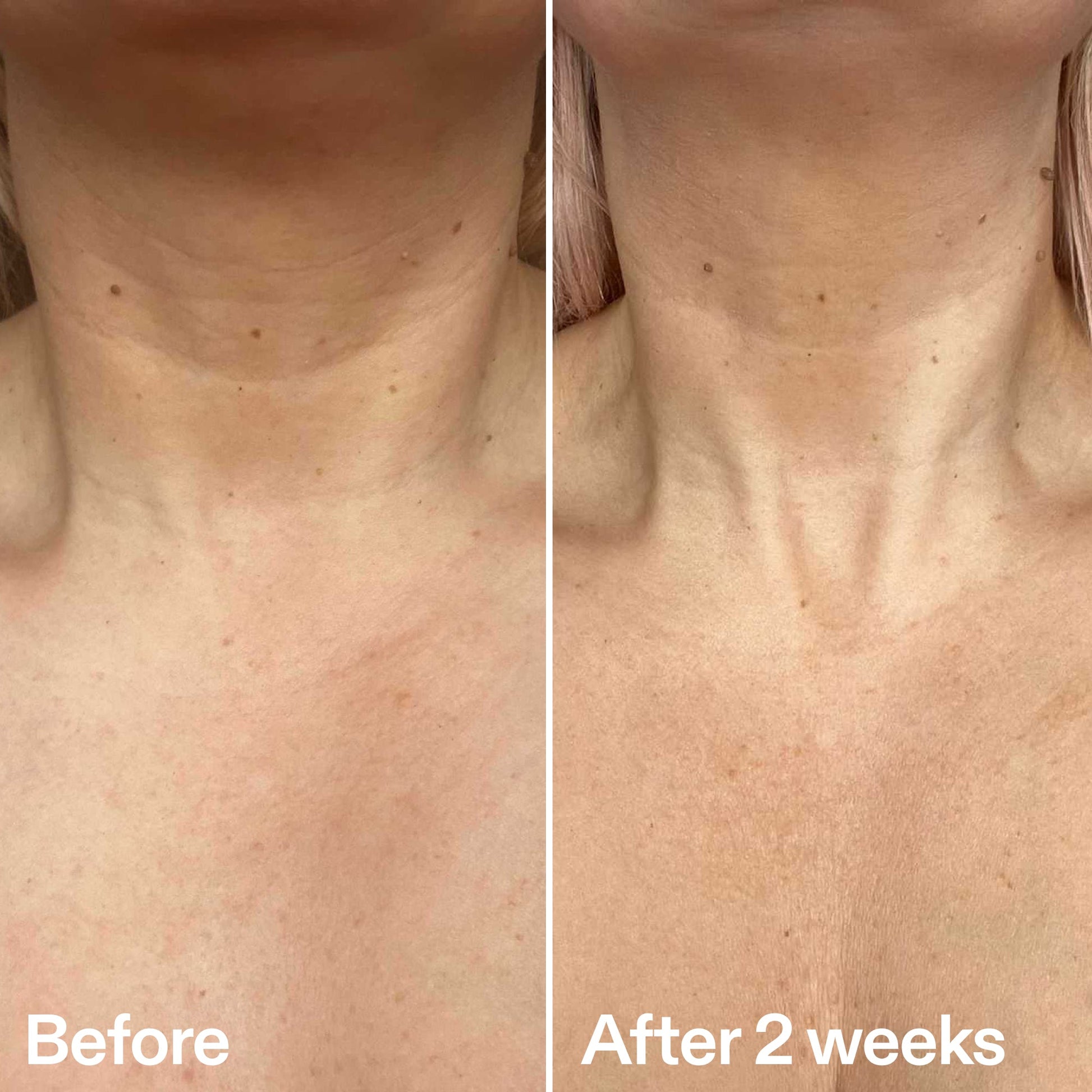bio-active-neck-lift-stick-k0 B_A_2.jpg