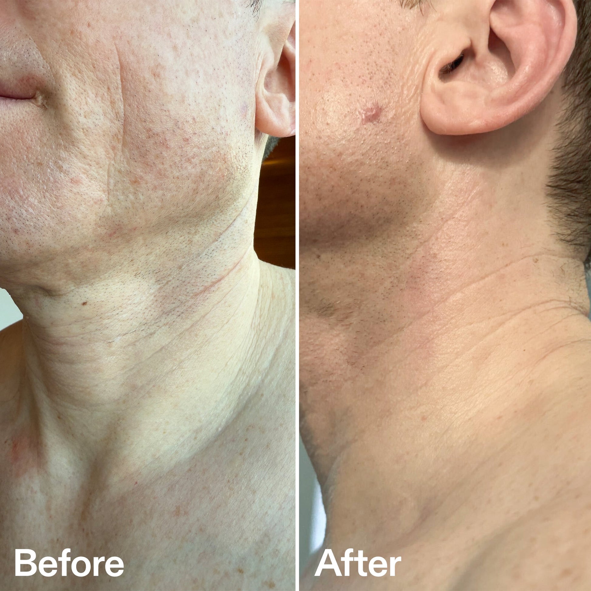 bio-active-neck-lift-stick-k0 B_A_afa2743e-b8e2-4504-92f4-e281cb6cf759.jpg