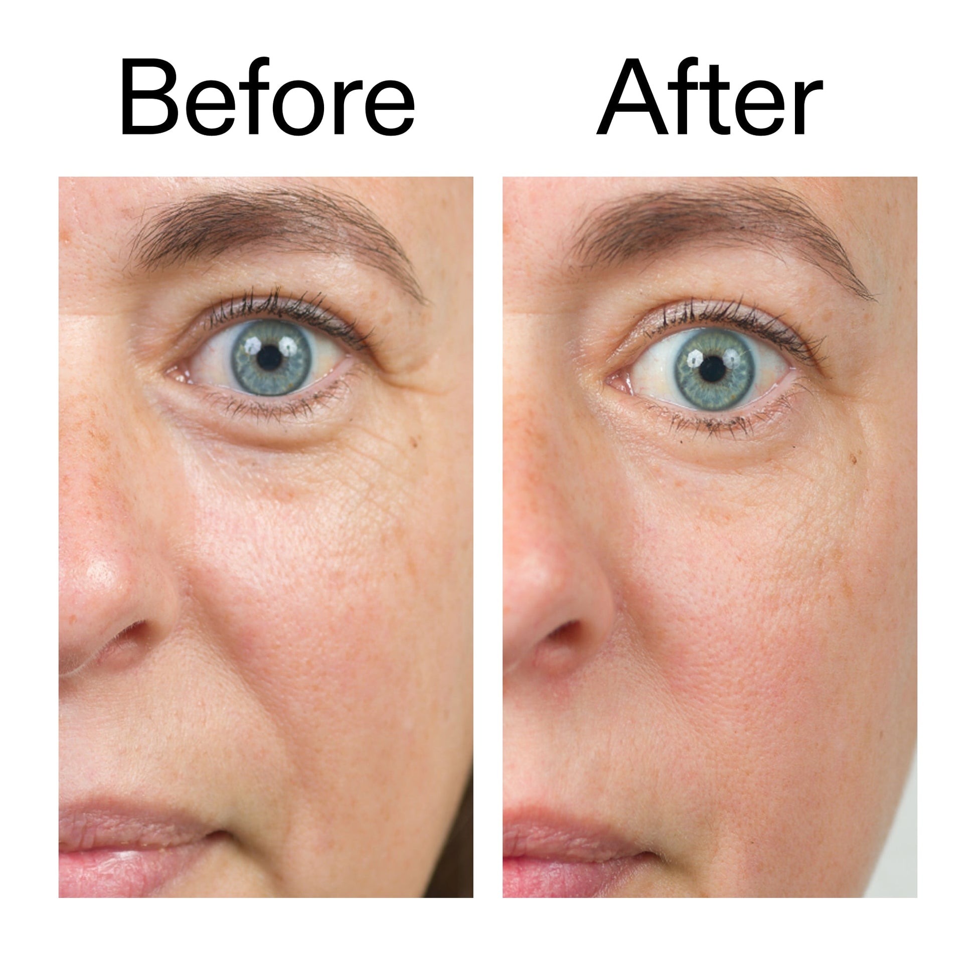 bio-active-ceramide-moisturizer-y6 Bio-Active_Before_After_2000x2000_566e5a9e-135e-417a-8242-b44e5fa35463.jpg
