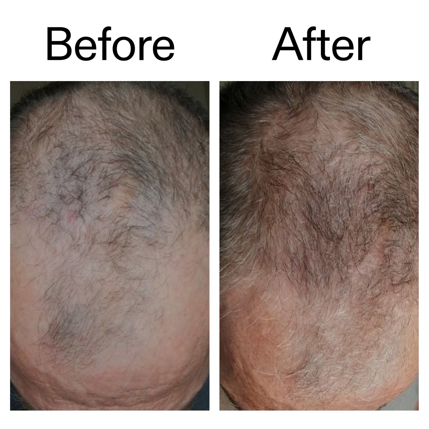 3-month-hair-growth-trio-n4 Caffeine_Scalp_Treatment_B_A_Ppage_2000_x_2000.jpg