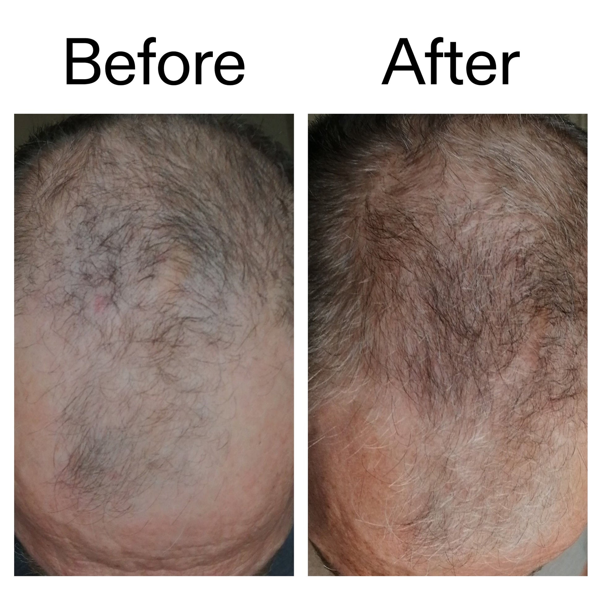 3-month-hair-growth-trio-n4 Caffeine_Scalp_Treatment_B_A_Ppage_2000_x_2000.jpg