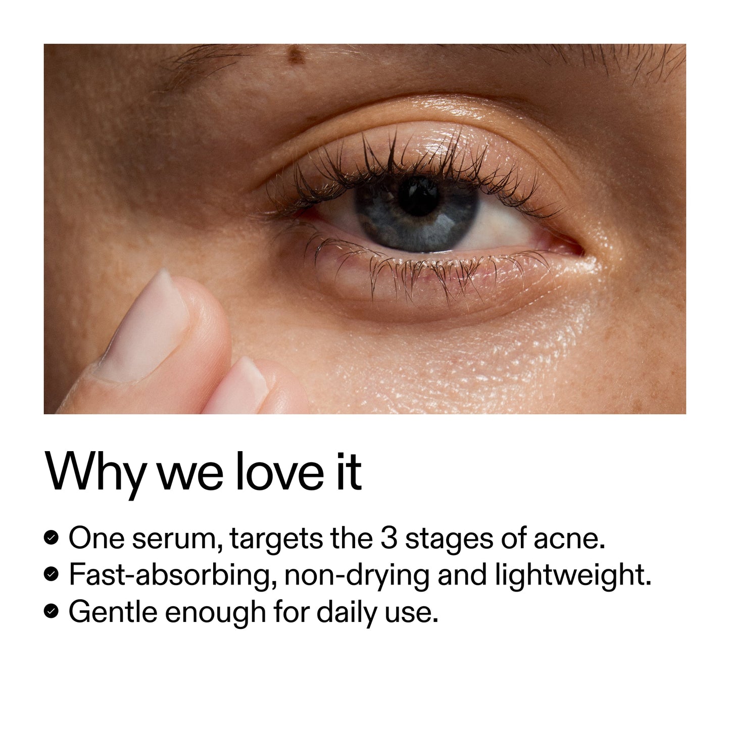 360-acne-clearing-serum-p7 Dioic_Whyweloveit_2000x2000_175aafd3-0cbe-403a-b317-a8362881bfe2.jpg