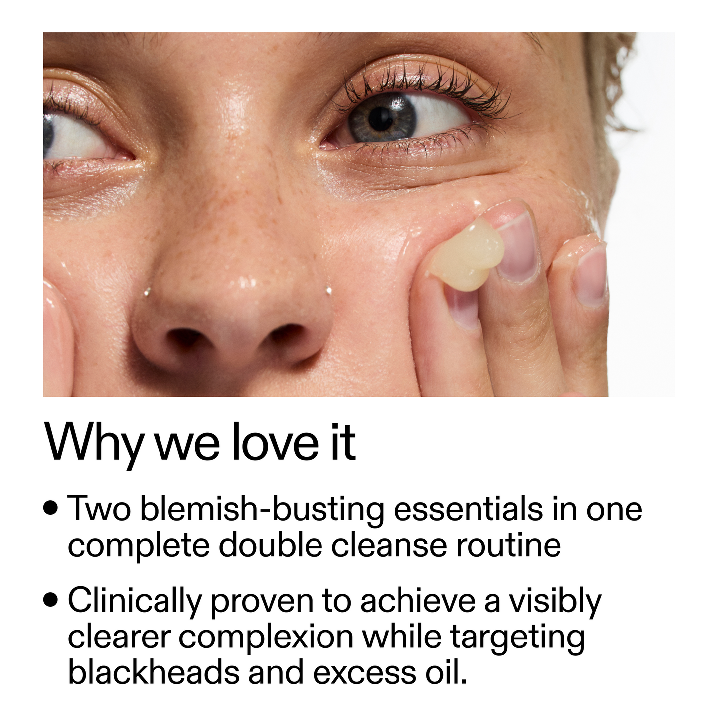 acne-double-cleanse-duo-t7 Double_Cleanse_Duo_for_Breakouts_Why_We_2000x2000_f242cb12-bb5c-487c-b203-071ccb406ec5.png