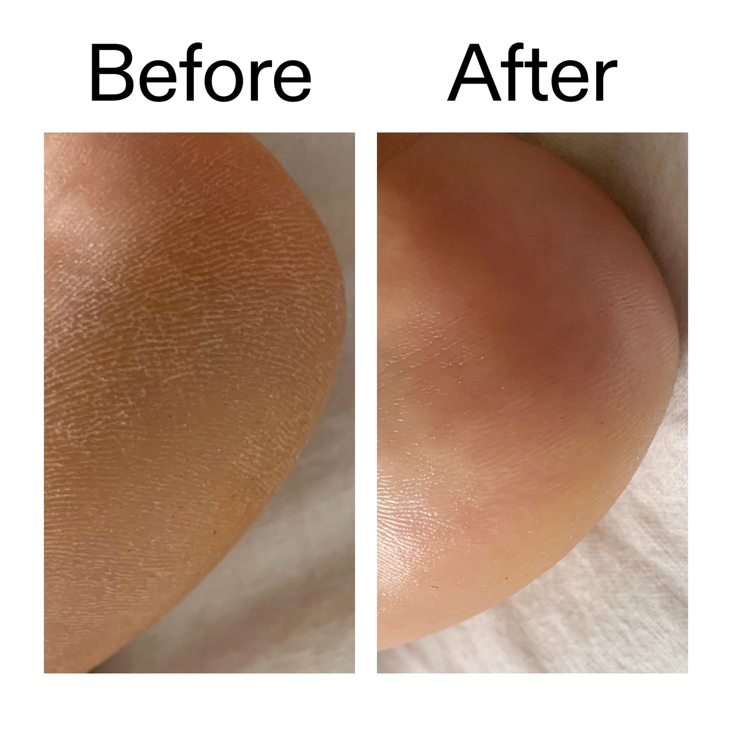 glycolic-acid-exfoliating-body-stick-duo-l8 Glycolic_Acid_Exfoliating_Body_Stick_Before_After_V1_2000x2000_a3043625-9400-429a-a7fb-d6dbd220f722.jpg