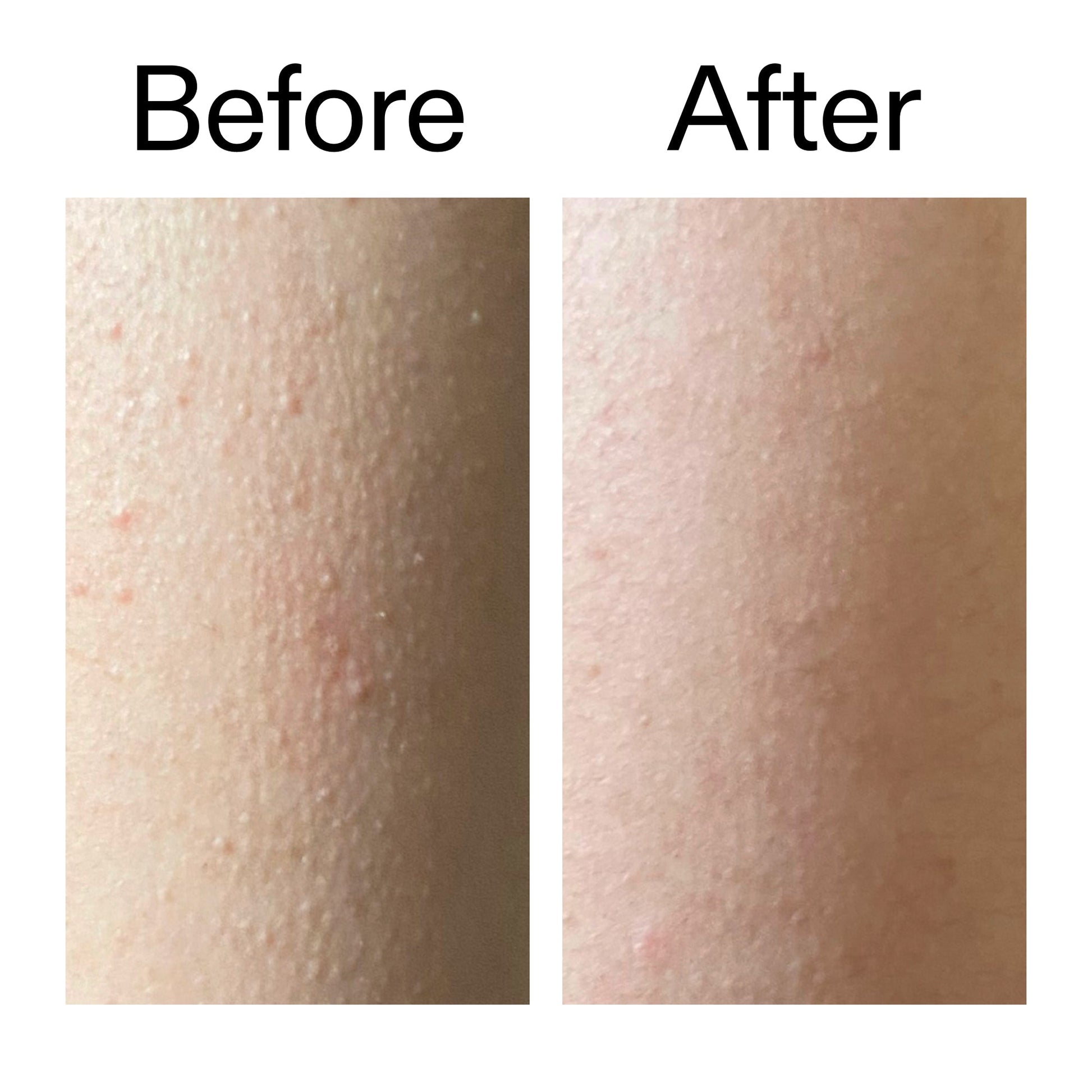 glycolic-acid-exfoliating-body-stick-y0 Glycolic_Acid_Exfoliating_Body_Stick_Before_After_V2_2000x2000_2e4ba052-94f6-4d56-82df-7bdb5b2df7ae.jpg