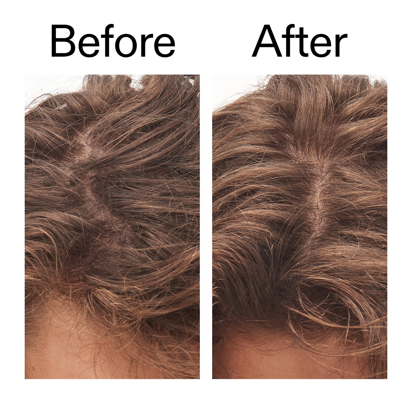 glycolic-acid-exfoliating-scalp-scrub-p3 Glycolic_Acid_Exfoliating_Scalp_Scrub_Before_After_2000x2000_b8561c87-05a1-4caa-80f7-1b6b33d750f7.jpg