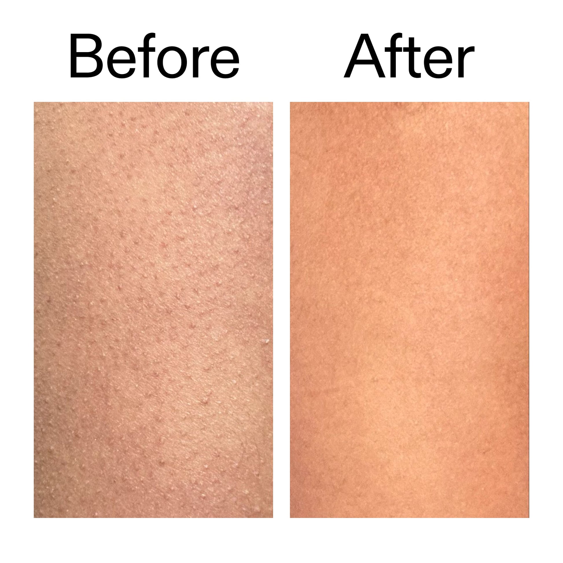glycolic-acid-exfoliating-body-stick-duo-l8 Glycolic_Body_Stick_B_A_2000x2000_6e6e6b4d-5bd7-43c0-aeed-4d66788e8995.jpg