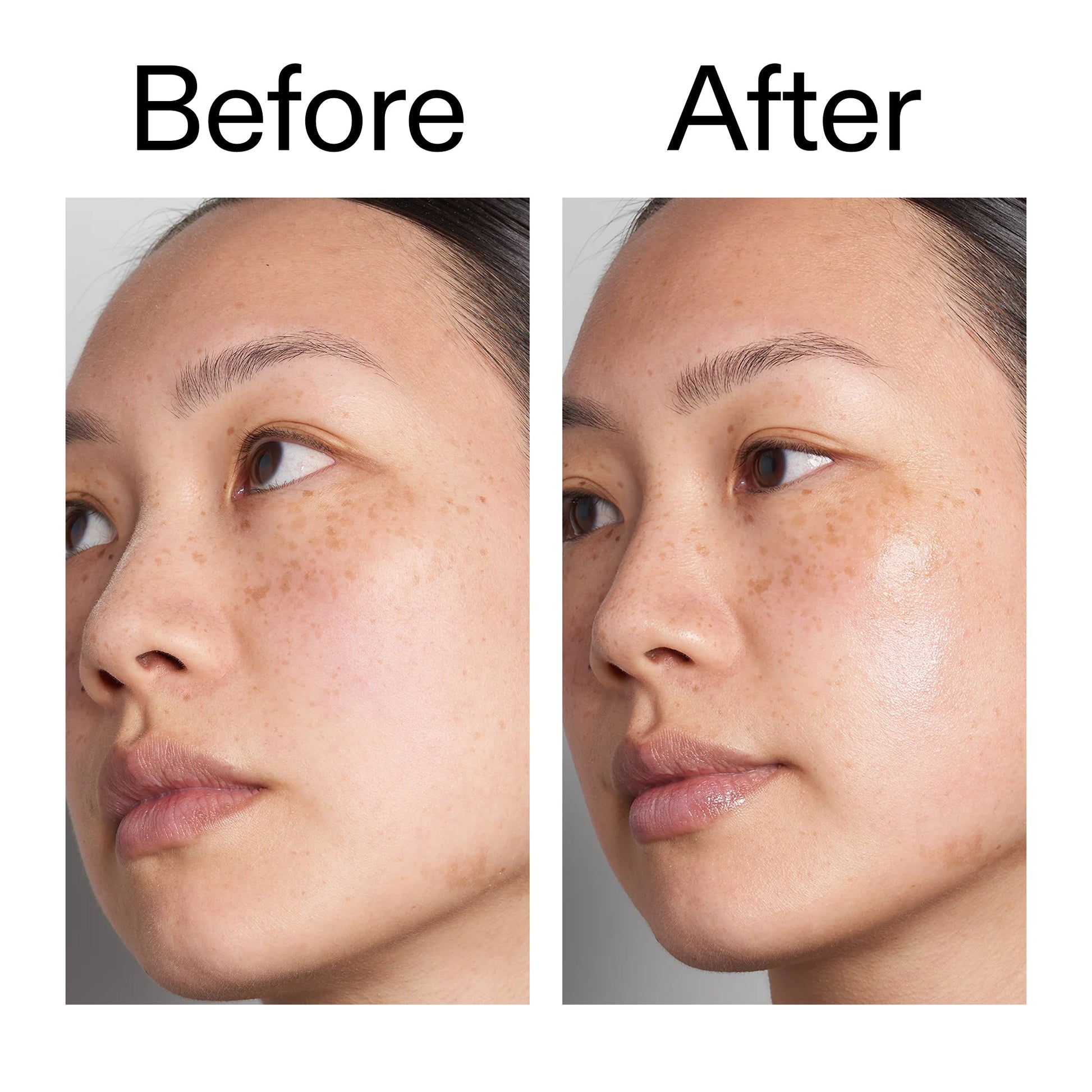 hyaluronic-acid-serum-30ml-f7 Hyaluronic_Acid_Before_After_2000x2000_d7983956-8aa2-4ea3-8255-c63e8d4f892e.jpg