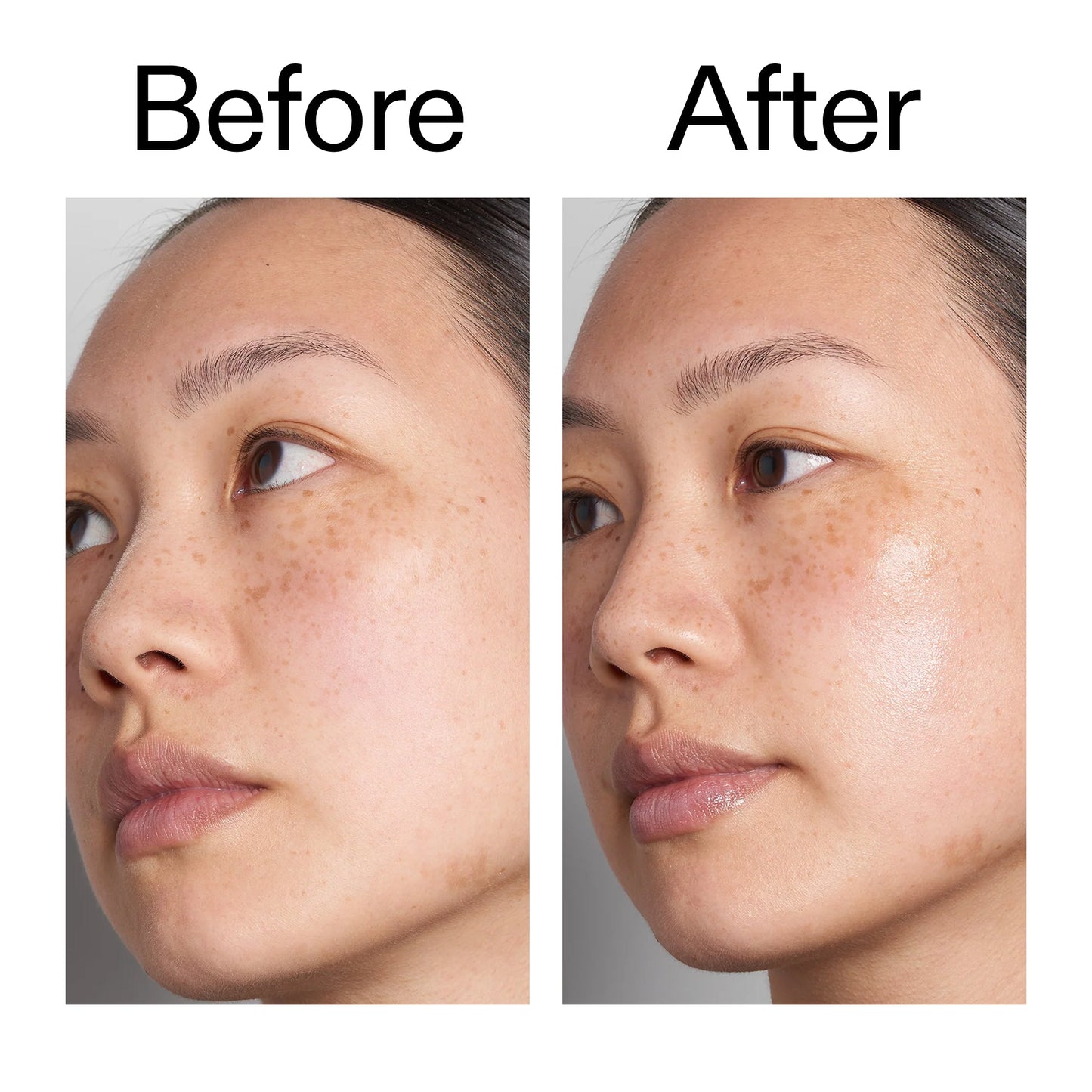 supersize-hyaluronic-acid-serum-100ml-p9 Hyaluronic_Acid_Before_After_2000x2000_d7983956-8aa2-4ea3-8255-c63e8d4f892e.jpg