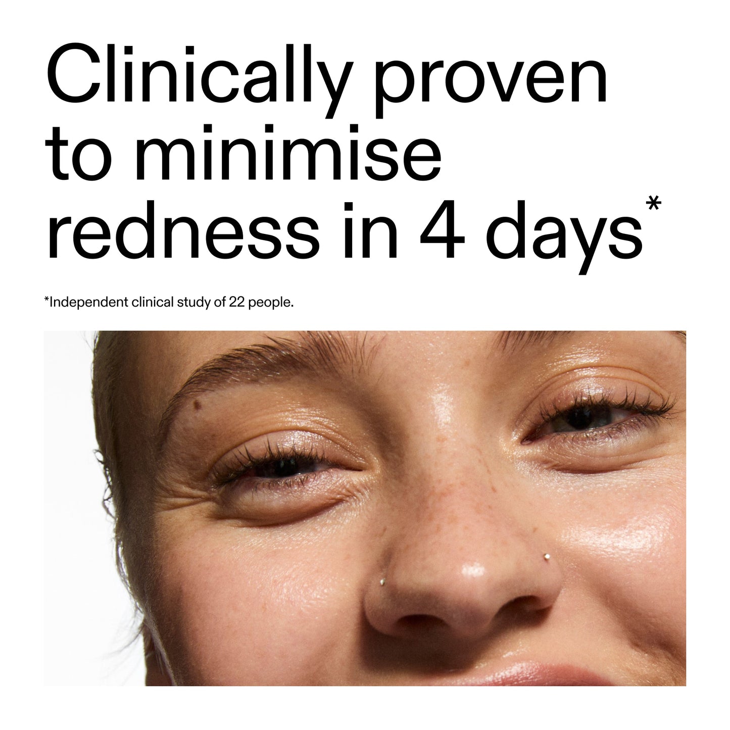 10-azelaic-acid-serum-for-redness-relief-b8 Oat_Cleansing_Balm_Claim_2000x2000_52a841dc-353c-4f2c-8646-3aadb604507d.jpg