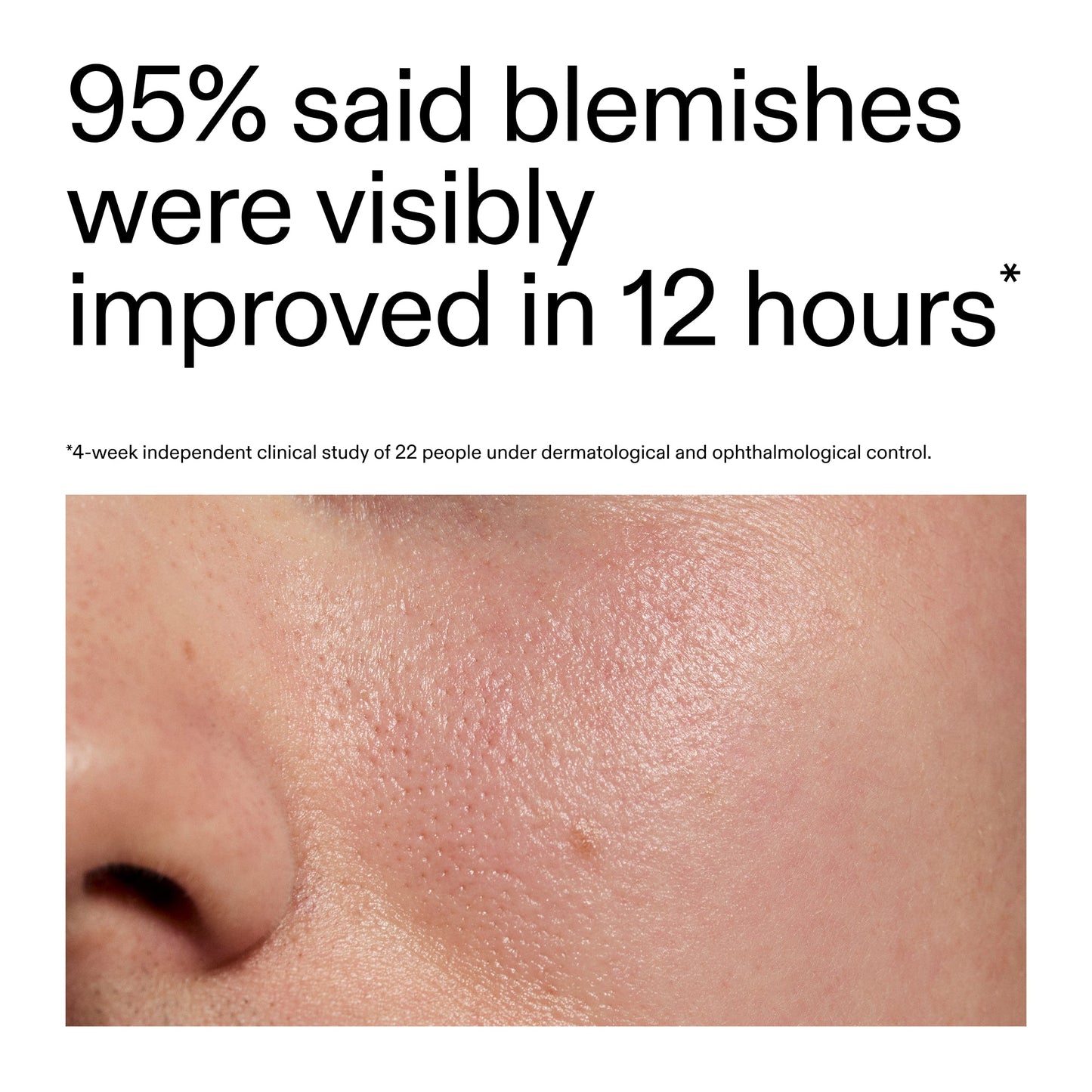 succinic-acid-acne-treatment-q1 Oat_Cleansing_Balm_Claim_2000x2000_ac6ce553-25db-41b2-a981-faae1ac4b8c0.jpg