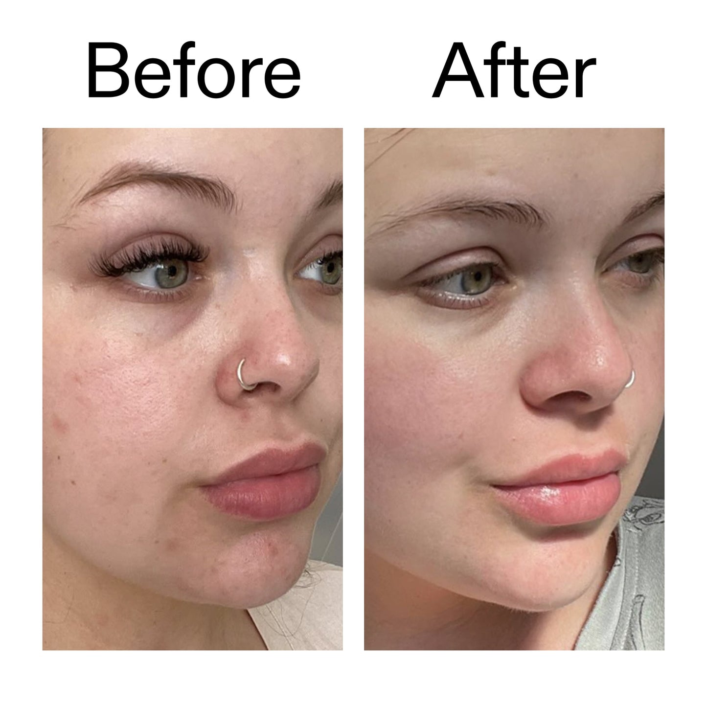 supersize-omega-water-cream-100ml-m6 Omega50_Before_After_2000x2000_46483ed8-3f9d-487f-9a0c-9df79830bd65.jpg