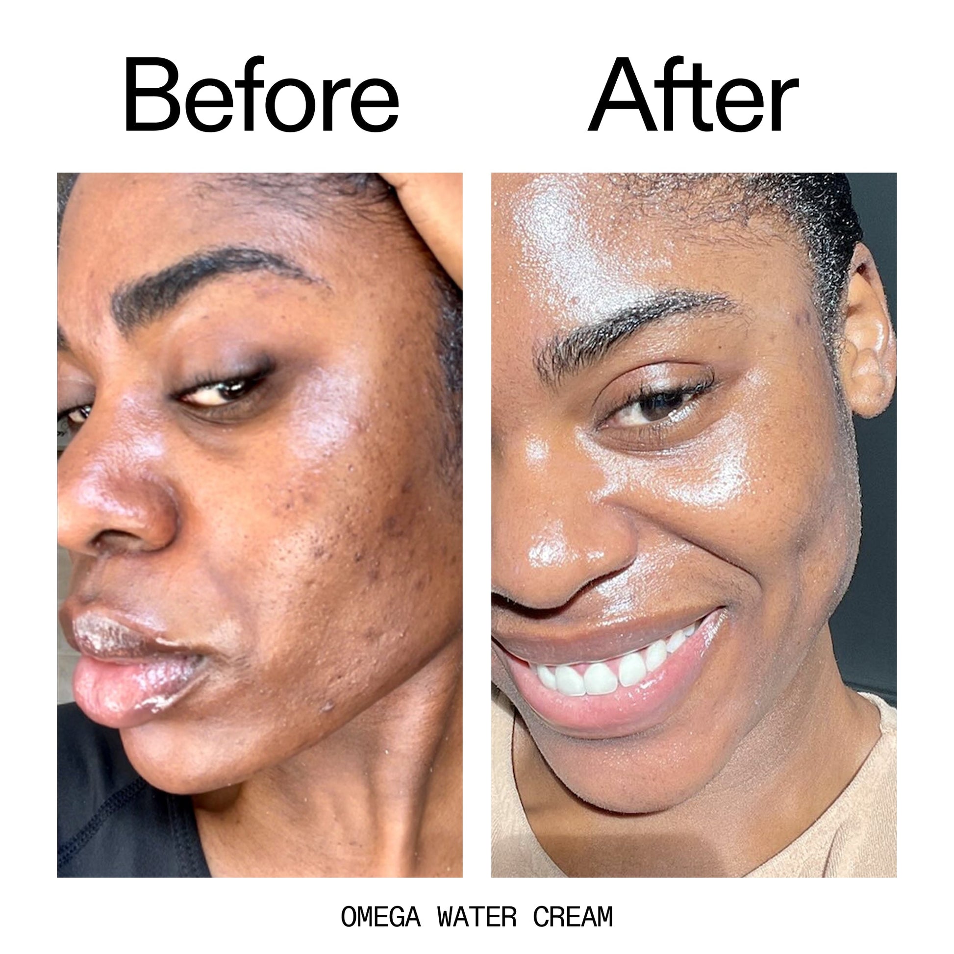 hydrating-cleanser-and-moisturizer-duo-z5 Omega_Water_Cream_Before_After_2000x2000_8e88278b-8c8d-48dc-ac77-4e98ebbd1b77.jpg