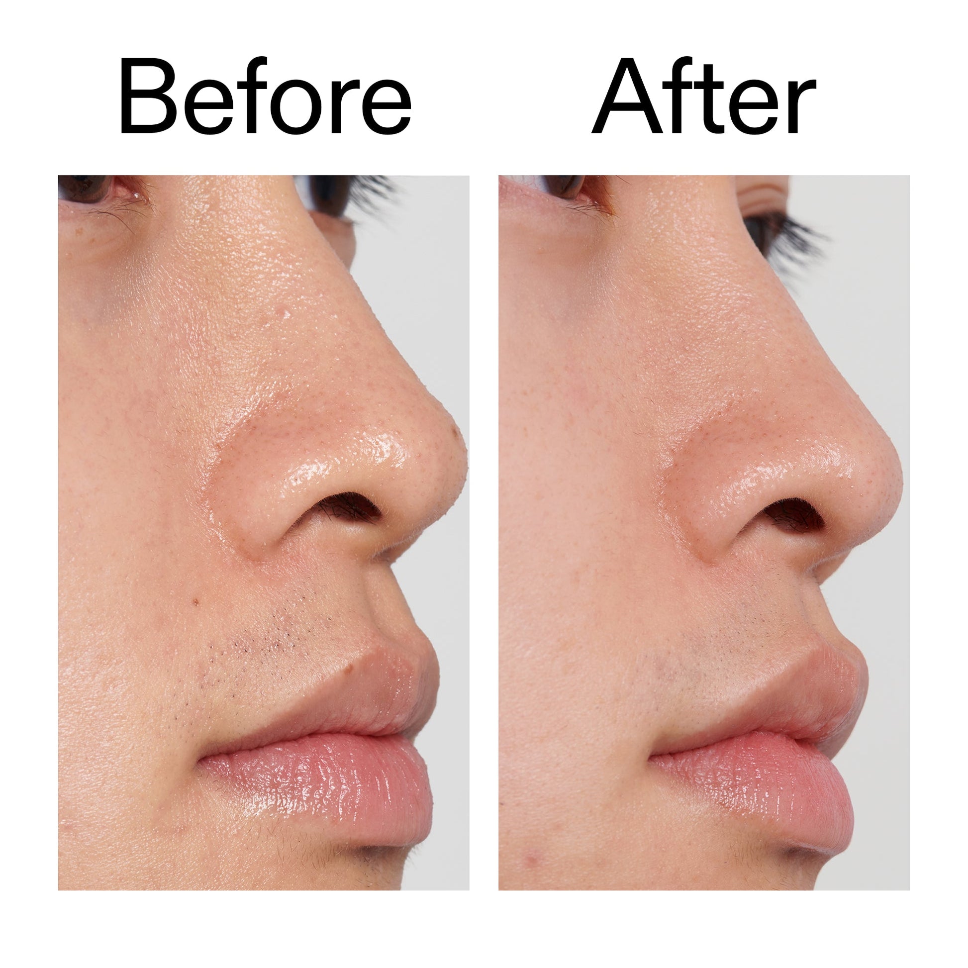 pha-toner-j0 PHA_Toner_Before_After_2000x2000_e3c10172-0150-4342-8b95-57417eaff50d.jpg
