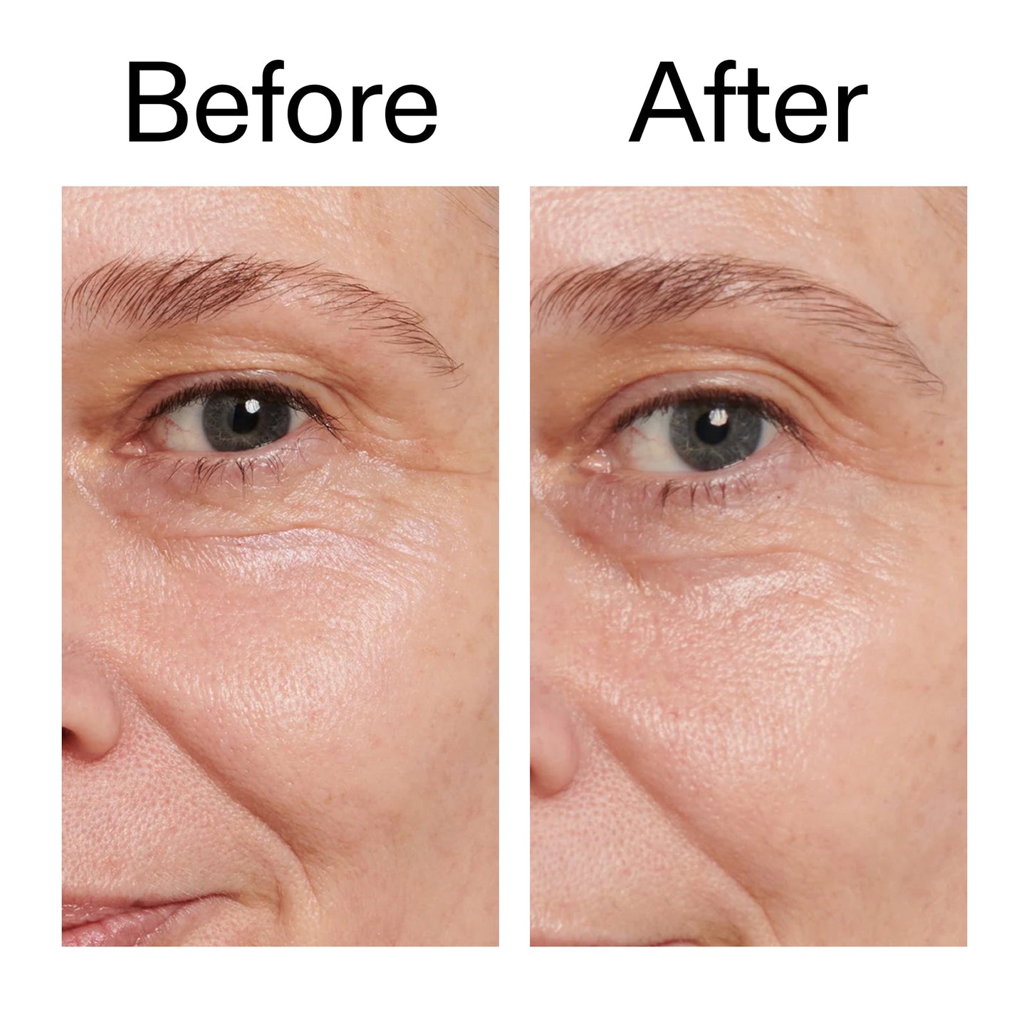 retinol-eye-cream-w6 Retinol_Eye_Cream_Before_After_2000x2000_ac03a80c-109e-4572-a95a-91dc109b4d27.jpg