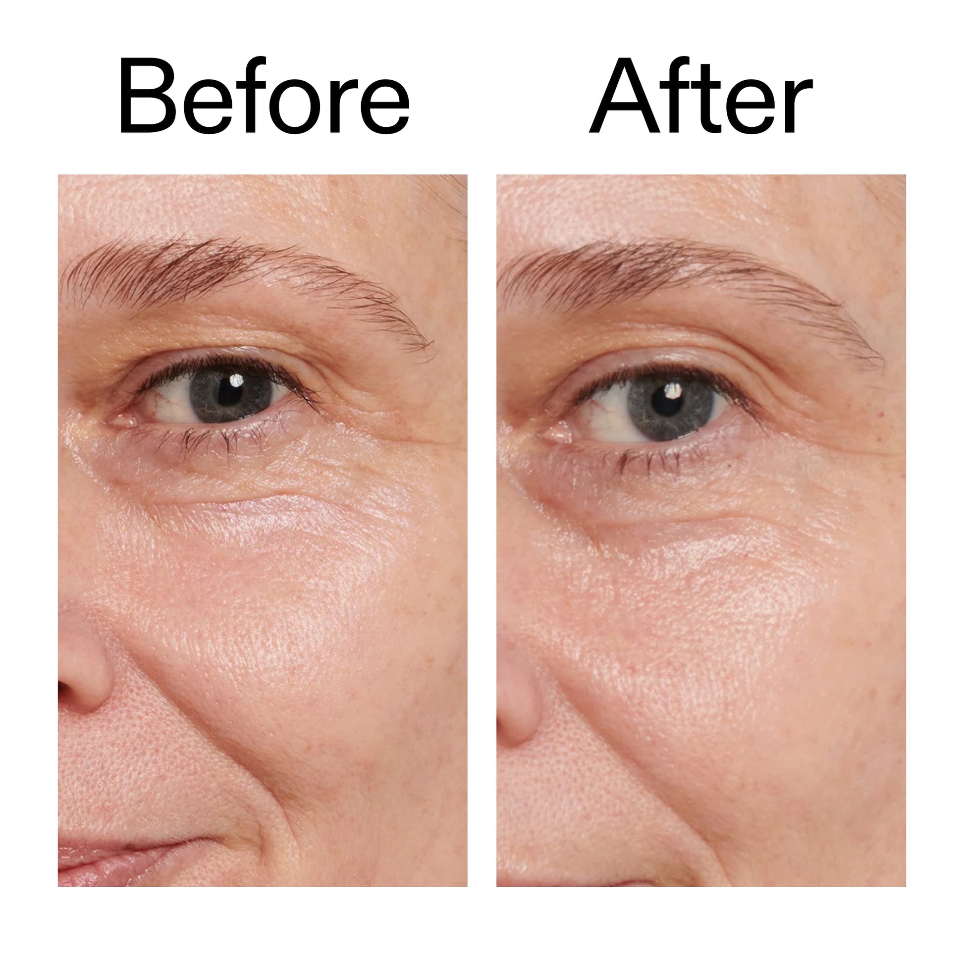 retinol-eye-cream-w6 Retinol_Eye_Cream_Before_After_2000x2000_ac03a80c-109e-4572-a95a-91dc109b4d27.jpg