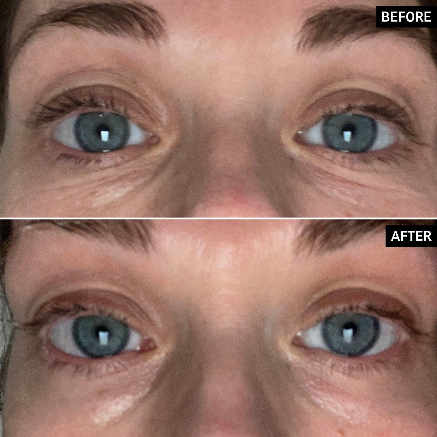 retinol-eye-cream-w6 SITE-UGCBAsApril_Nicole_B_A_PPage_2000x2000_1.jpg