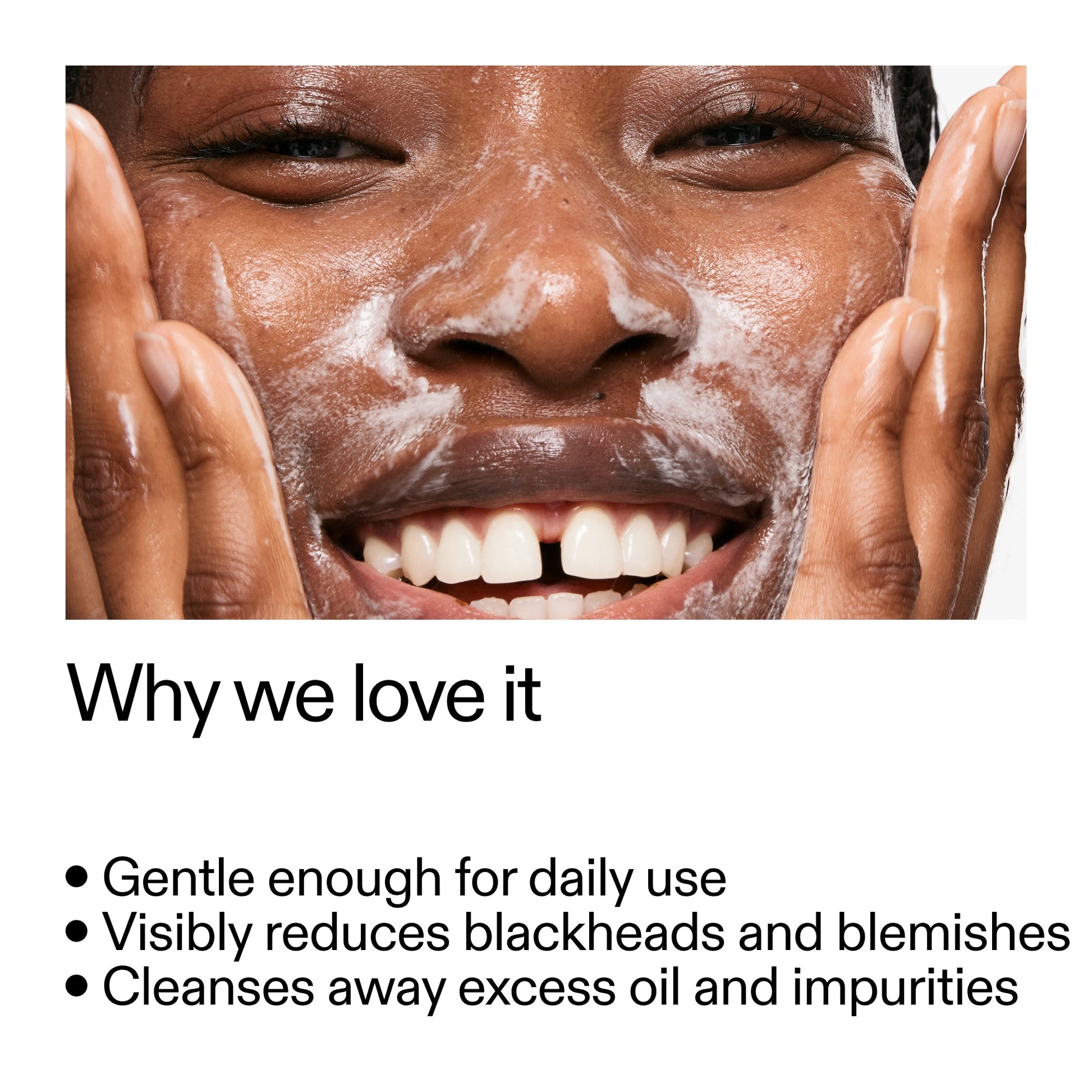 salicylic-acid-cleanser-duo-s4 Salicylic_Acid_Cleanser_-_300mlWhy_we_love_it_2000x2000_87dc92a9-2559-4309-98cd-4e570f1be735.jpg