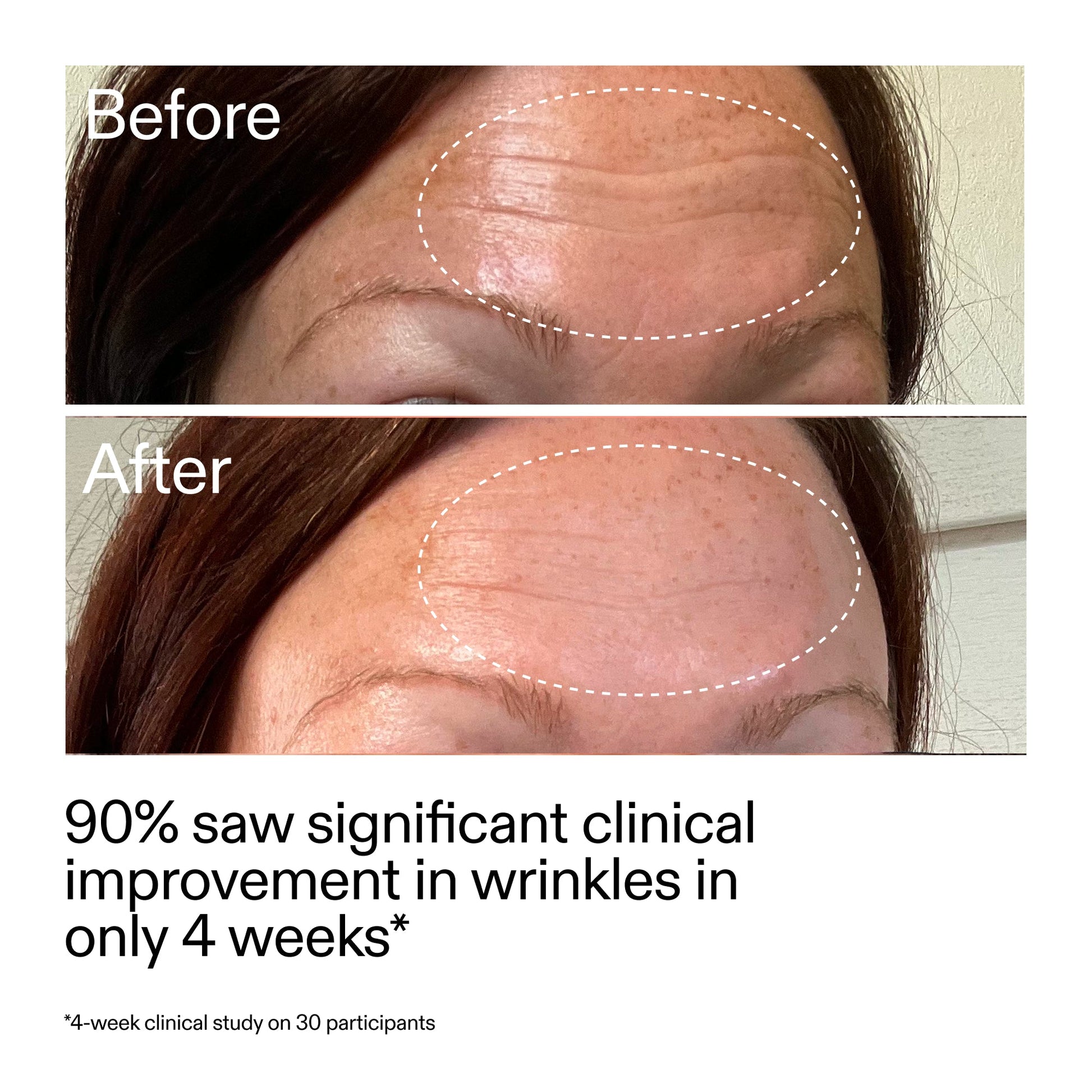 starter-retinol-serum-l6 StarterRetinol_BeforeAfter_Claim1_2000x2000_a09b50b6-4688-4527-abae-21bd142b89b7.jpg