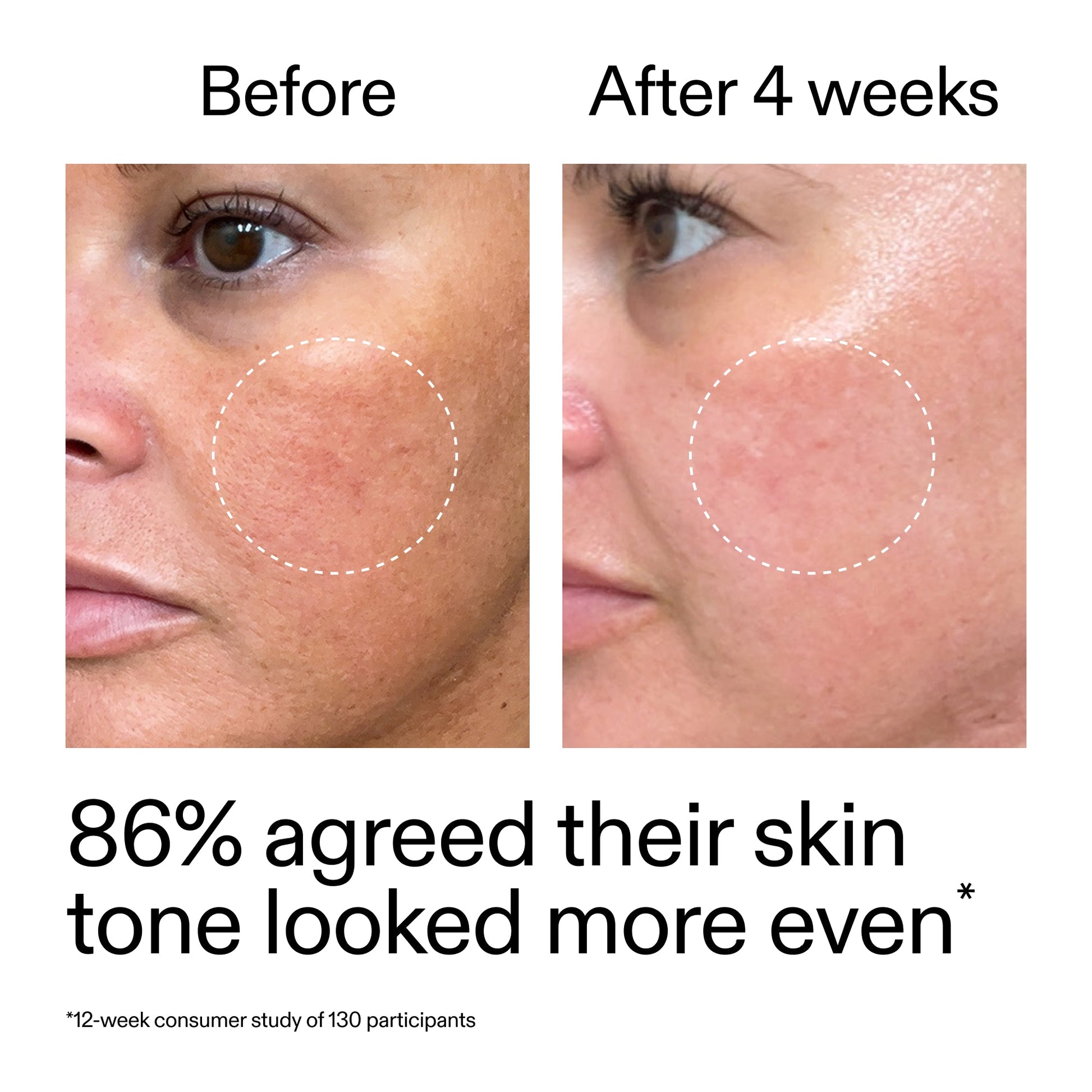 starter-retinol-serum-l6 StarterRetinol_BeforeAfter_Claim2_2000x2000_f5c9ecc0-8d76-429d-bef5-c3a61bcf5c09.jpg