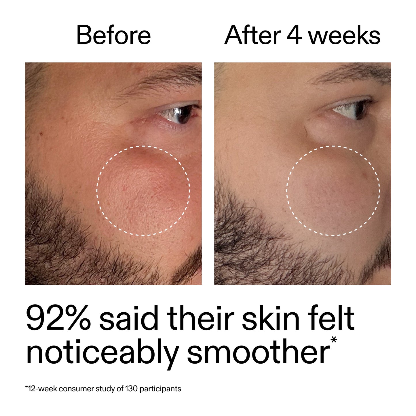 starter-retinol-serum-duo-j8 StarterRetinol_BeforeAfter_Claim3_2000x2000_458243a8-bbb0-4e5d-a274-29c7766d339b.jpg