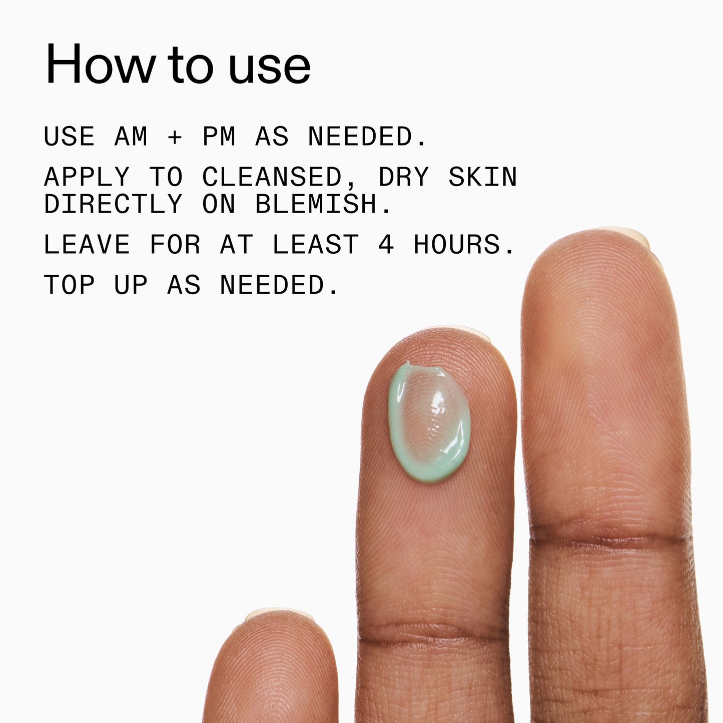 succinic-acid-acne-treatment-q1 Succinic_Acid_Treatment_How_to_Use_2000x2000_d57137d5-d7f1-427c-9a46-5fc00c19c542.jpg