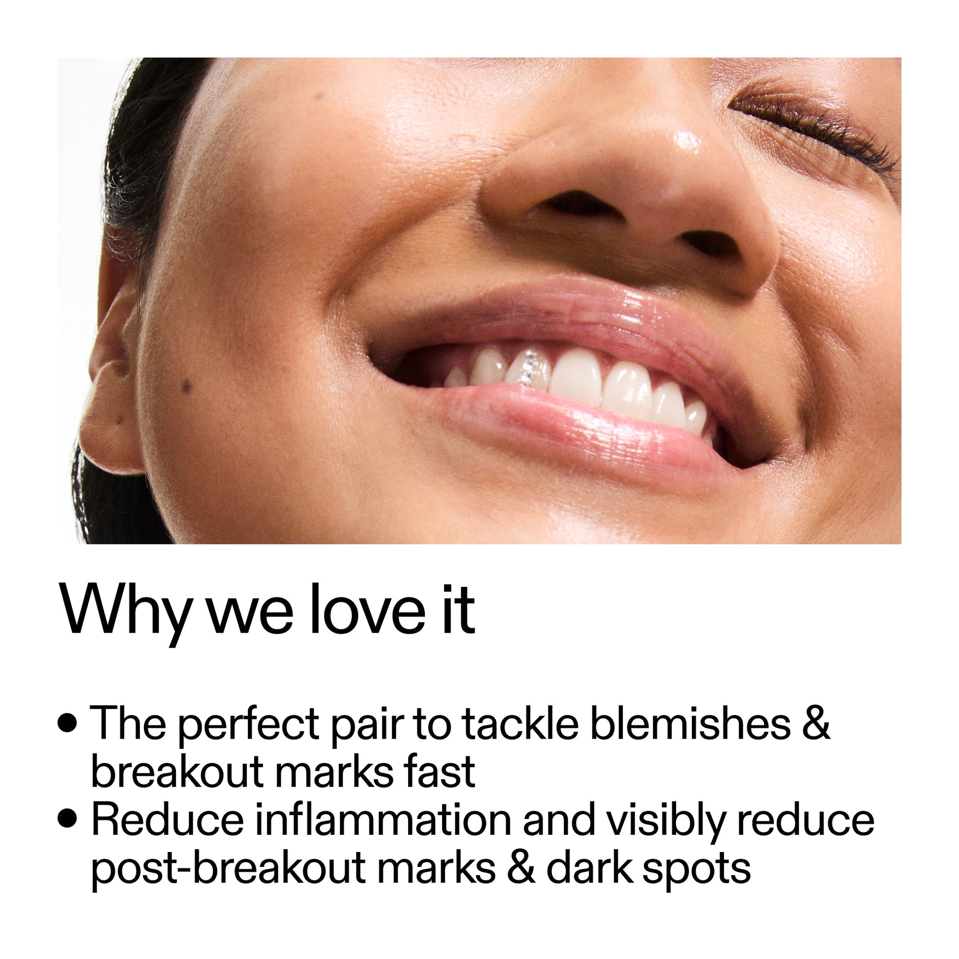 targeted-blemish-duo-h3 Targeted_Blemish_Duo_Why_we_love_it_2000x2000_ff00be46-438b-485f-b5c3-91e60bbb6919.jpg