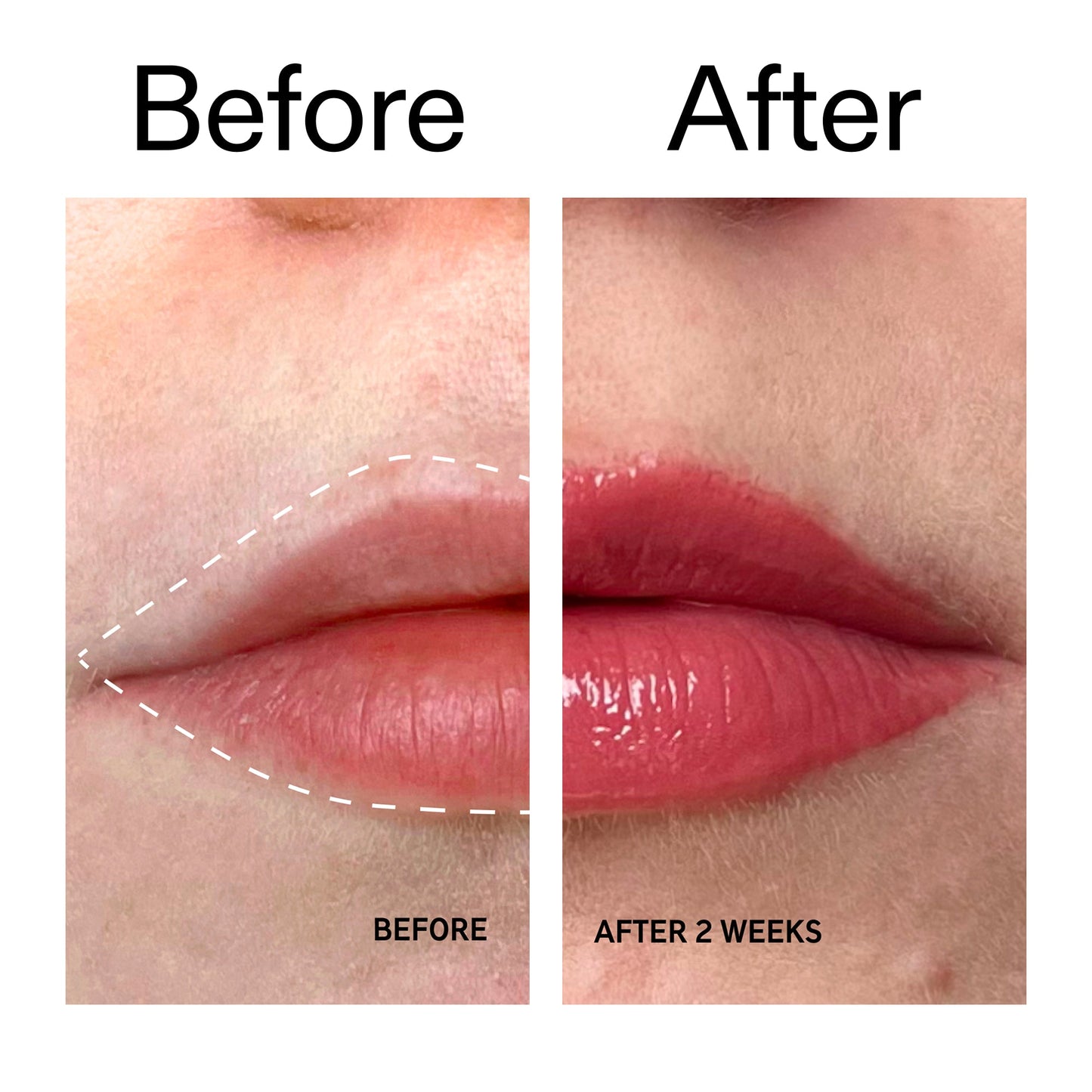 tripeptide-plumping-berry-lip-balm-s8 Tripeptide_Plumping_Lip_Balm_-_Berry_Before_After_2000x2000_9474bbd8-43ca-4b0e-b0e7-dfab70b91927.jpg