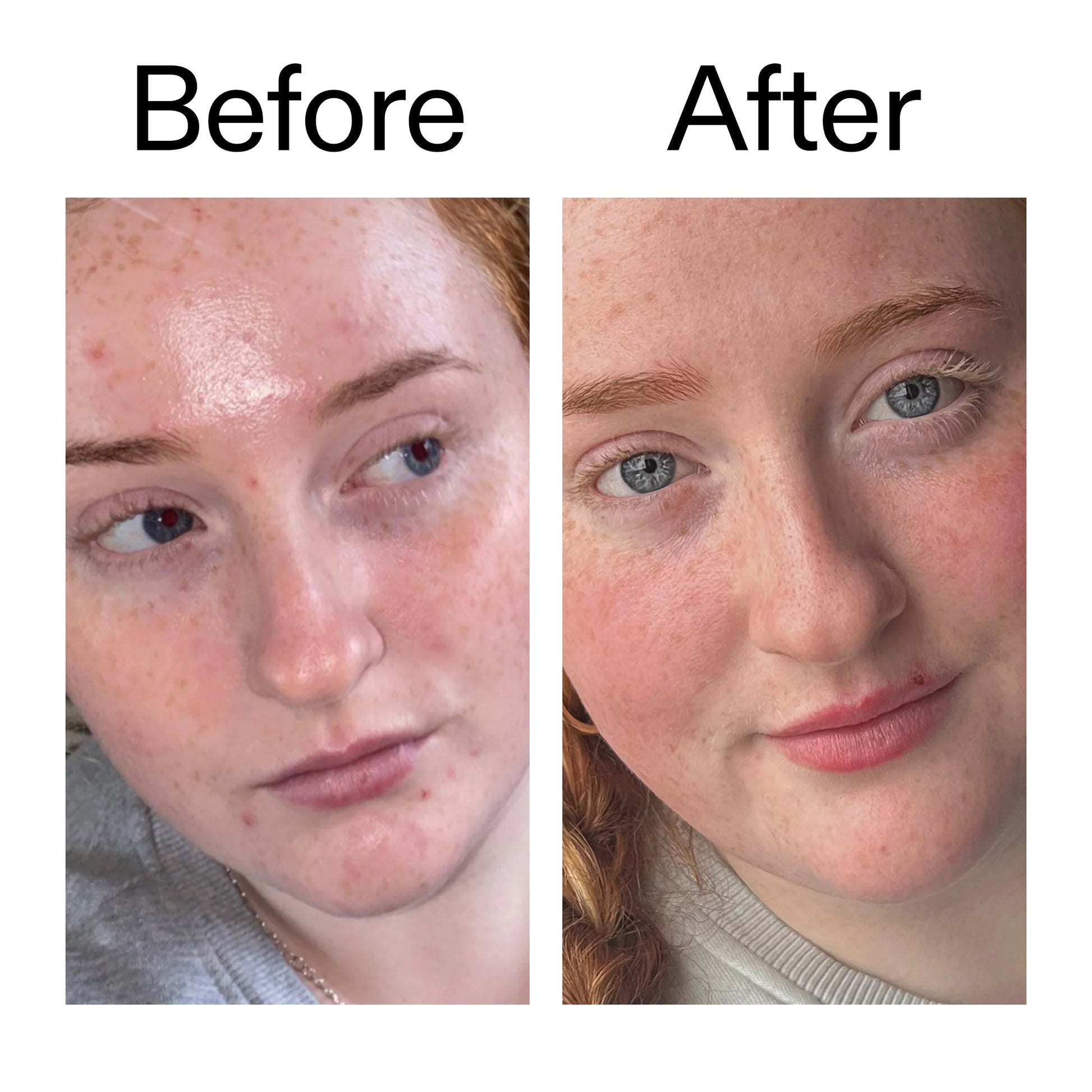 vitamin-b-c-and-e-moisturizer-a0 Vitamin_B_C_and_E_Moisturizer_Before_After_2000x2000_b0781a76-5ad2-4be9-95b8-ef92b356833c.jpg